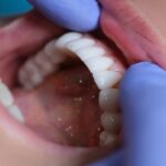 Certain Devices Used to Treat OSA May Not Be Safe: US FDA