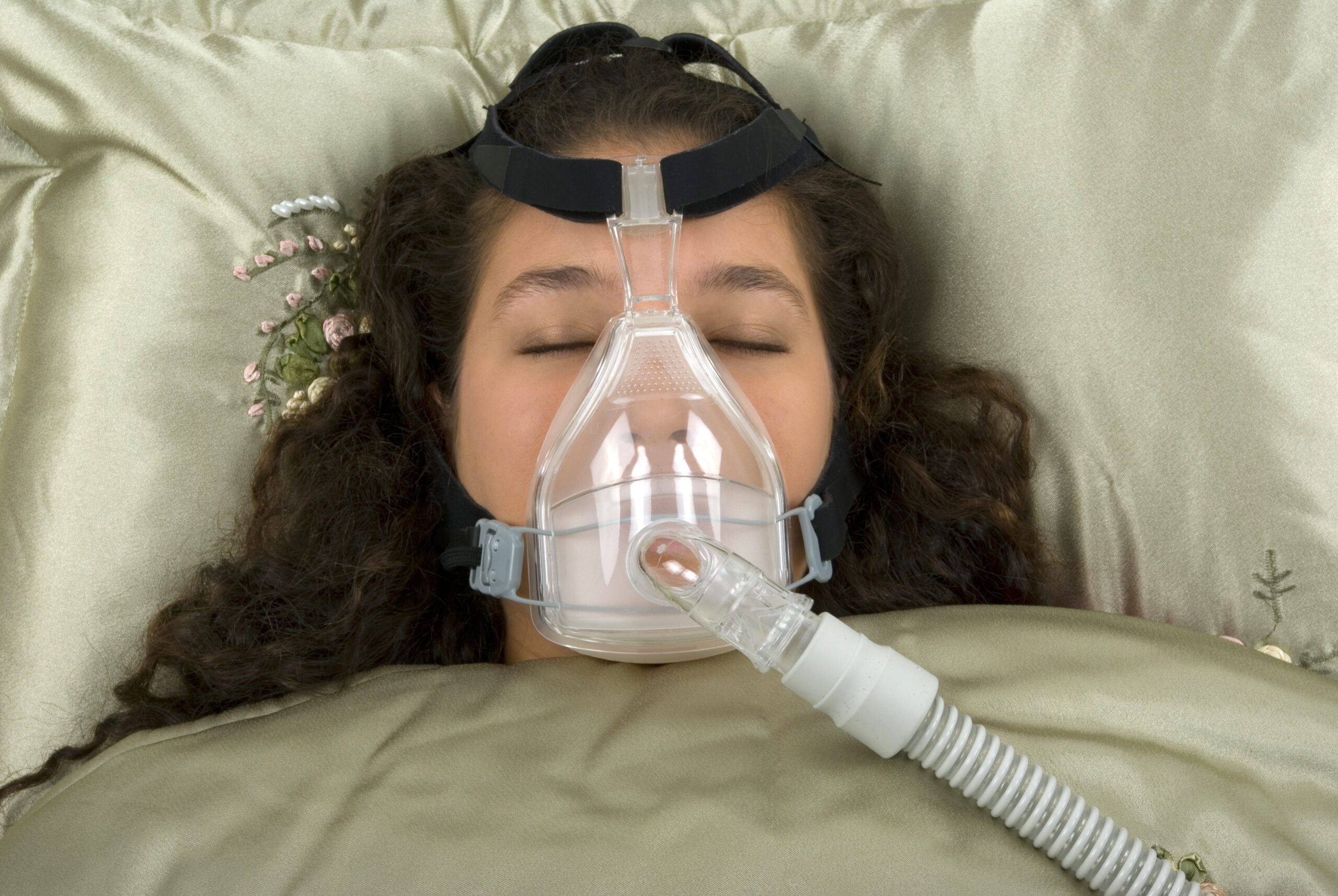 159833 sleep apnea 1 scaled